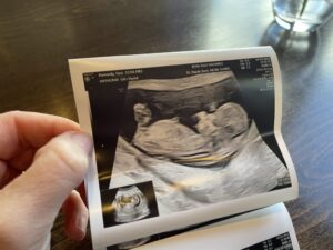 pregnancy ireland