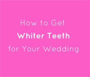 Comment avoir des dents plus blanches - Mariage fait main